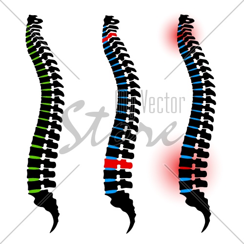 vector human spine silhouettes