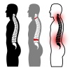 vector human spine silhouettes